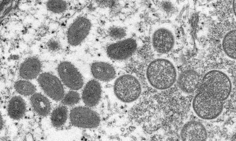 virus variola macaco